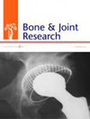 Bone & Joint Research]